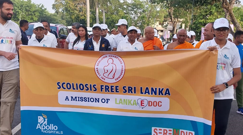 පොත් බෑග් නිසා දරුවන් විශාල ප්රමාණයකට කොඳු ඇට පෙළේ ආබාධ පොත් බෑග් නිසා දරුවන් විශාල ප්රමාණයකට කොඳු ඇට පෙළේ ආබාධ