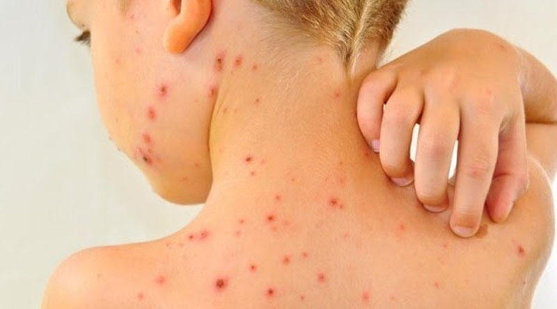 සරම්ප නැවත ව්‍යාප්ත­වීමේ අව­දා­න­මක්